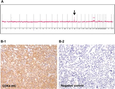 Array Comparative Genomic Hybridization ACGH Of The Primary Tumor