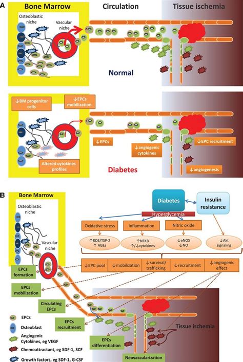 Specific Role Of Impaired Glucose Metabolism And Diabetes Mellitus In