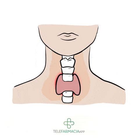 Esses S O Os Sinais De Problema Na Tireoide