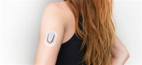 Dexcom Sensor and Transmitter applied on an arm [14]. | Download ...