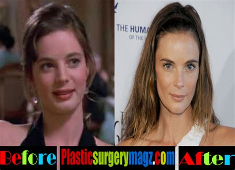 Gabrielle Anwar Plastic Surgery Before and After | | Plastic Surgery ...