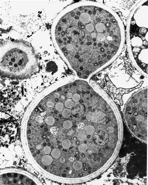 Cell Under Electron Microscope Hot Sex Picture