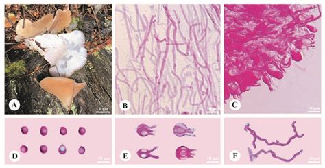 Basidiomata And Microscopic Structures Of Pseudohydnum Sinogelatinosum