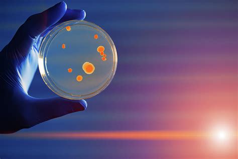 Scientist Holding Petri Dish With Bacteria By Wladimir Bulgarscience