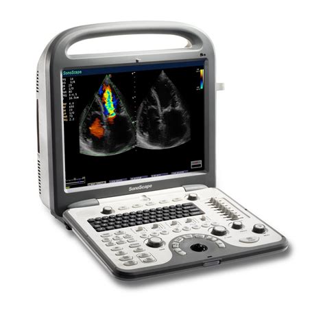 Sonoscape 3D 4D Color Doppler Portable Laptop Ultrasound System Machine