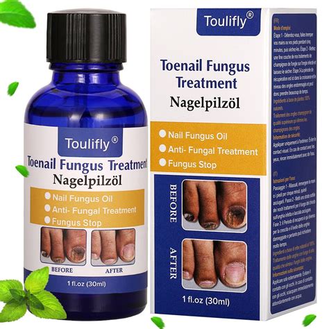 Best Fungal Nail Treatment Uk Tablets At Kelley Waterman Blog