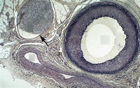 BY 115 - Arteries and Veins Histology Diagram | Quizlet