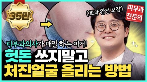 하루 5분이면 10년은 젊어집니다 피부과의사도 열심히 하는 얼굴 운동법 동안 얼굴 이렇게 만드세요 레비나스