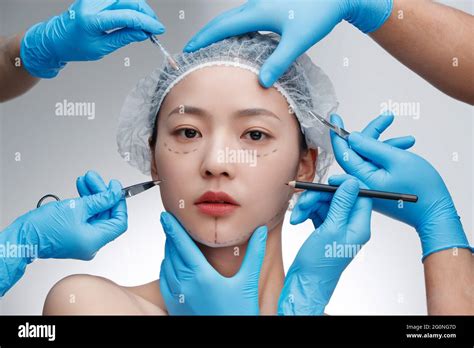 Young women have plastic surgery Stock Photo - Alamy