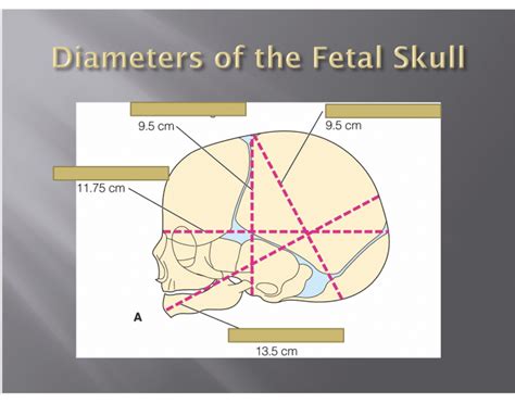 diameters of fetal skull Quiz