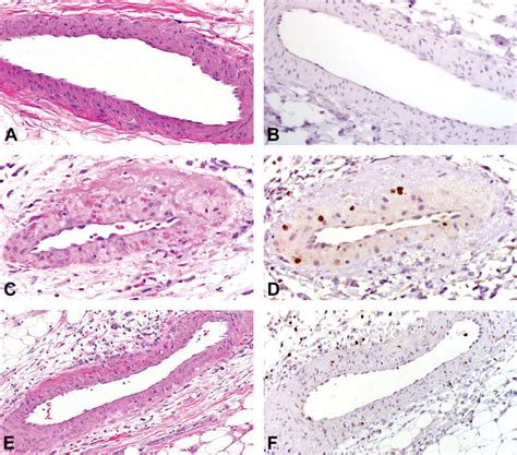 Representative Images Showing Histopathology Of Drug Induced Vascular