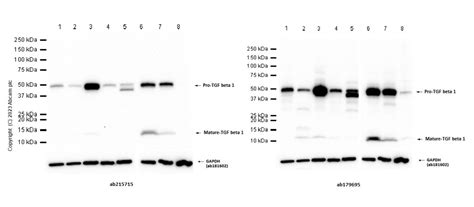 Recombinant Anti TGF Beta 1 Antibody EPR21143 KO Tested Ab215715