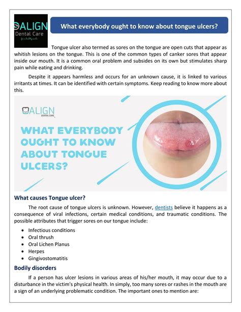 What are the factors behind ulcers on the tongue? by Align Dental Care ...