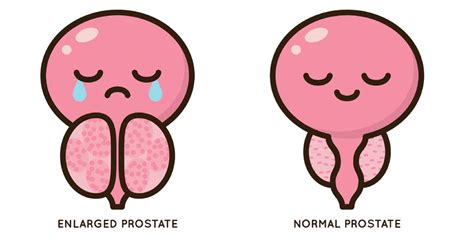 What Effect Does an Enlarged Bladder Have on You?