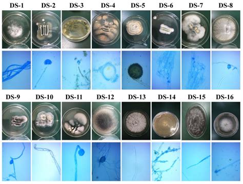 Types Of Microscopic Fungi