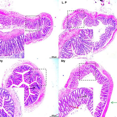 L Plantarum Alleviates The Damage Induced By S Typhimurium In Mice