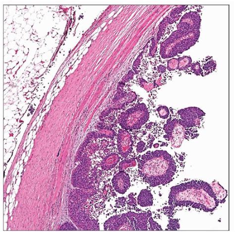 Renal Pelvis Histology Labeled