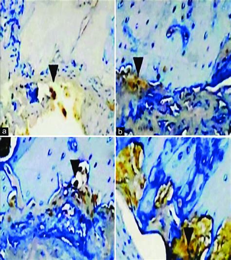 Representative Micrographic Photograph Of The Immunohistochemical