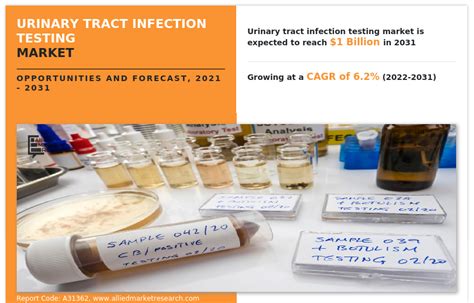 Urinary Tract Infection Testing Market Sets New Record Projected At