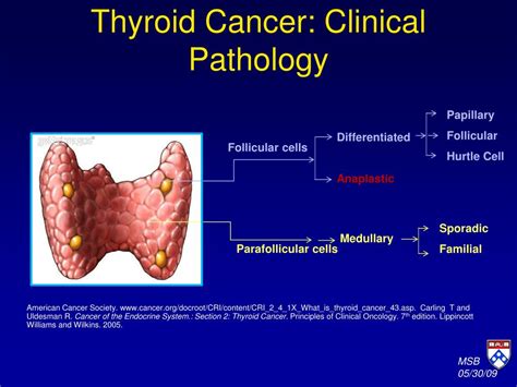 Ppt Advances In The Management Of Iodine Refractory Thyroid Cancers