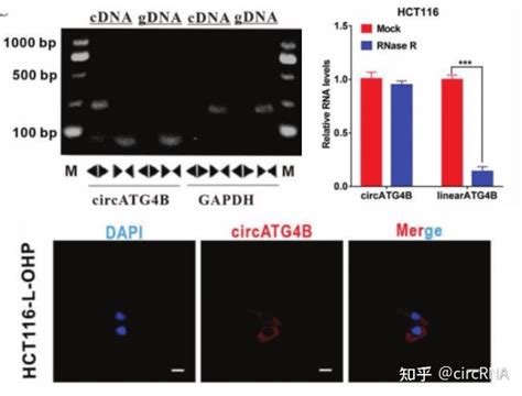 Advanced Science 外泌体circrna可编码新型蛋白质诱导结直肠癌细胞自噬并产生奥沙利铂耐药性 知乎