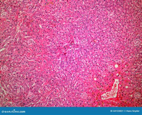 Histology Of The Normal Liver Stock Image Image Of Microscopic