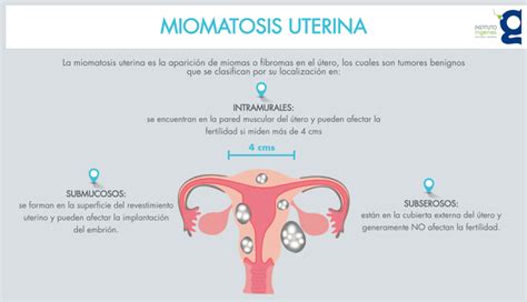 ¿qué Es La Miomatosis Uterina Y Cómo Afecta Tu Fertilidad