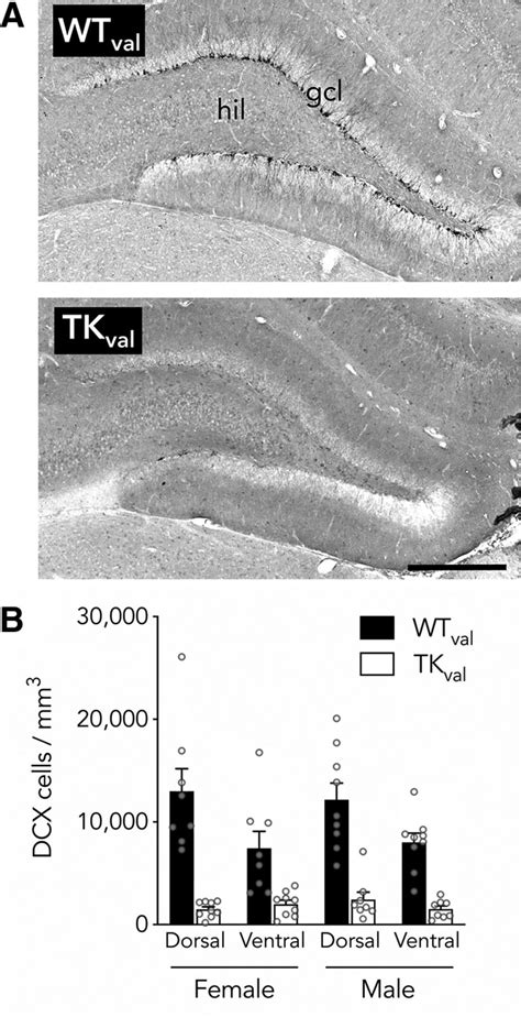 Sex Differences In The Spatial Behavior Functions Of Adult Born Neurons In Rats ENeuro