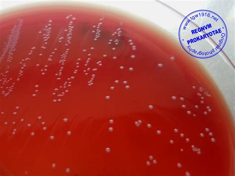 Enterococcus Faecalis Morphology