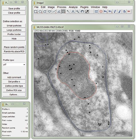 Analysis Of Double Immunogold Labeling In Axon Terminals Using Imagej