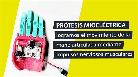 Pr Tesis Mioel Ctrica De Mano Impresa En D Youtube