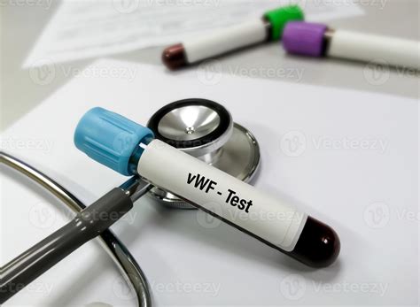 Blood Sample Isolated With Stethoscope For Von Willebrand Factor Vwf