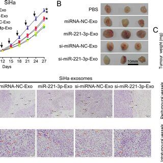 Cscc Exosomal Mir P Promotes Huvec Angiogenesis In Vitro Huvecs