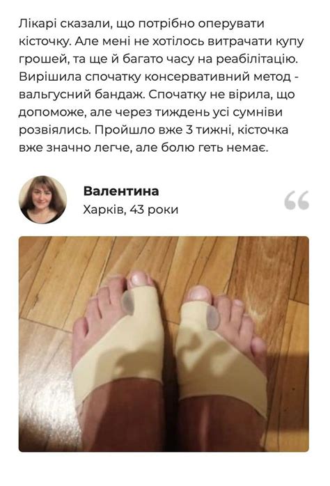 Бандаж на стопу – lollyta.store