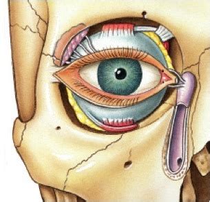 Diagram of flow of lacrimal fluid diagram | Quizlet