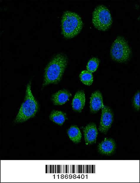 Rabbit Anti Cfh Polyclonal Antibody Center Absin