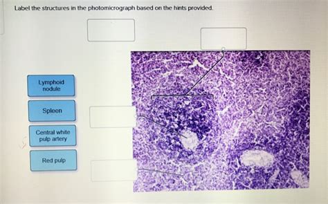 Solved Label The Structures In The Photomicrograph Based On Chegg