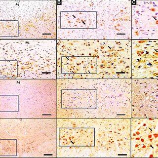 Photomicrographs of coronal section in the dorsal raphe nucleus of the ...