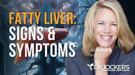 Fatty Liver Signs And Symptoms Dr David Jockers Youtube