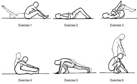 Lumbar Lordosis - Exercises, How to Fix, Treatment, What is