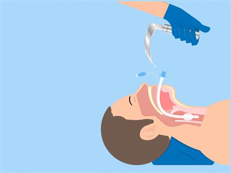Ларингоскопия в Москве (Отрадное и Митино), цена на исследование ...