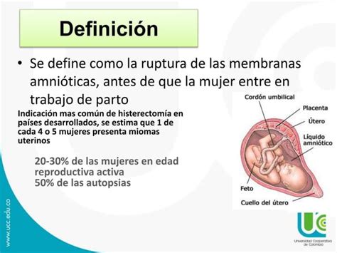 Ruptura Prematura De Membranas Ppt