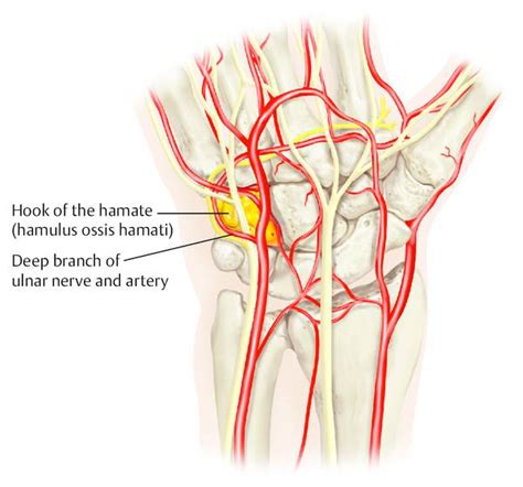 Hamate and Hook of the Hamate Fractures | Musculoskeletal Key