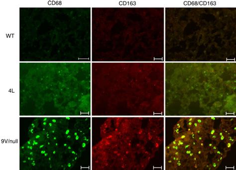 Expression Of The Scavenger Receptor Cd163 And Cd68 In Lung