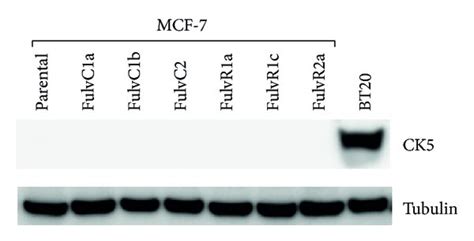 A Relative Expression Of Estrogen Receptor ER Progesterone