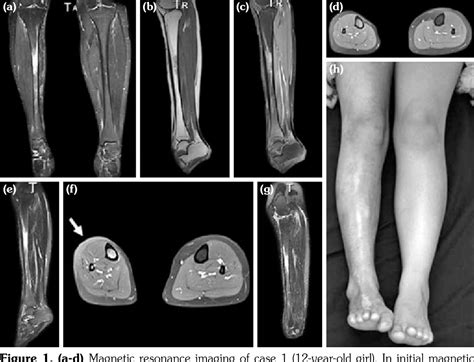 Figure 1 From Clinical Usefulness Of Magnetic Resonance Imaging In Four