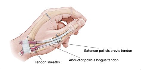 Thumb Tendon Anatomy - Anatomical Charts & Posters