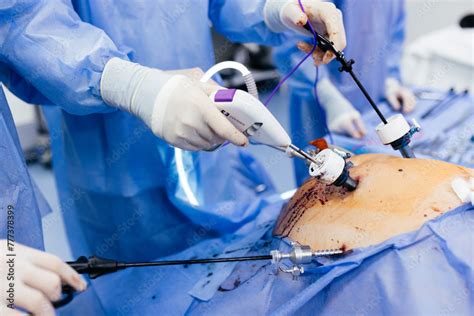 Instruments For Gastroscopy And Colonoscopy Close Up The Doctor Holds