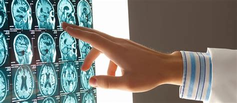 Bsc Medical Imaging Technology Akash Institutions Bangalore