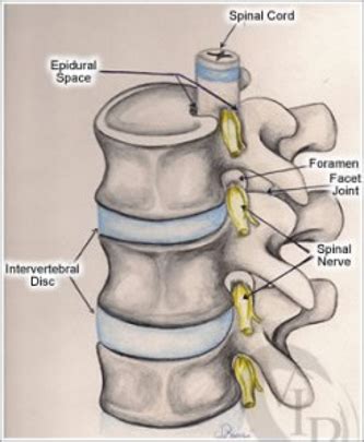 Selective Nerve Root Block [Updated 2025] - Legacy Spine & Neurological Specialists